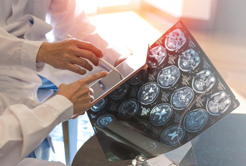 Doctors review imaging results to determine MS diagnosis